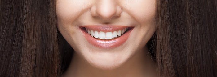 At-Home-Teeth-Whitening-More-Than-a-White-Bright-Smile-700x250
