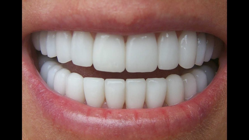 Dental Whitening Tips for a Bright and Beautiful Smile!