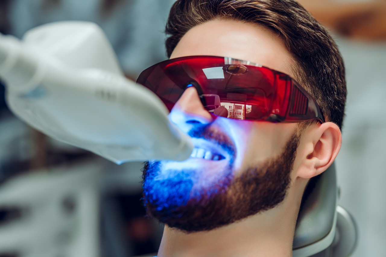 Laser Teeth Wheitening