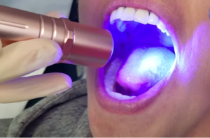 A picture containing person, closeup, oral cancer screening
