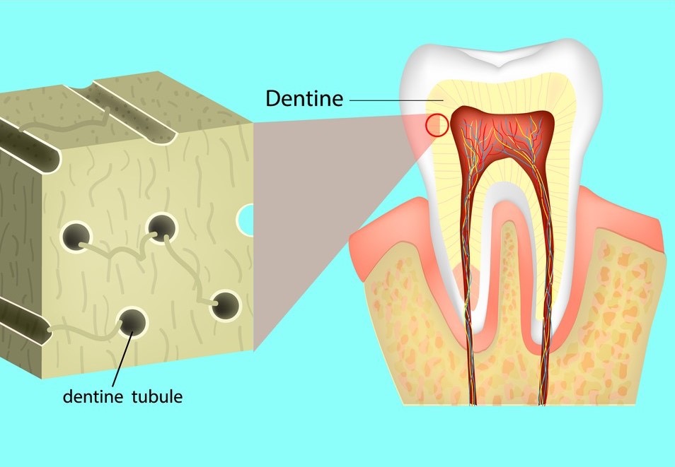 A diagram of a tooth, dentine, What Causes Tooth Sensitivity?